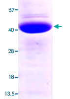 Loading 3 μg protein in 15% SDS-PAGE
